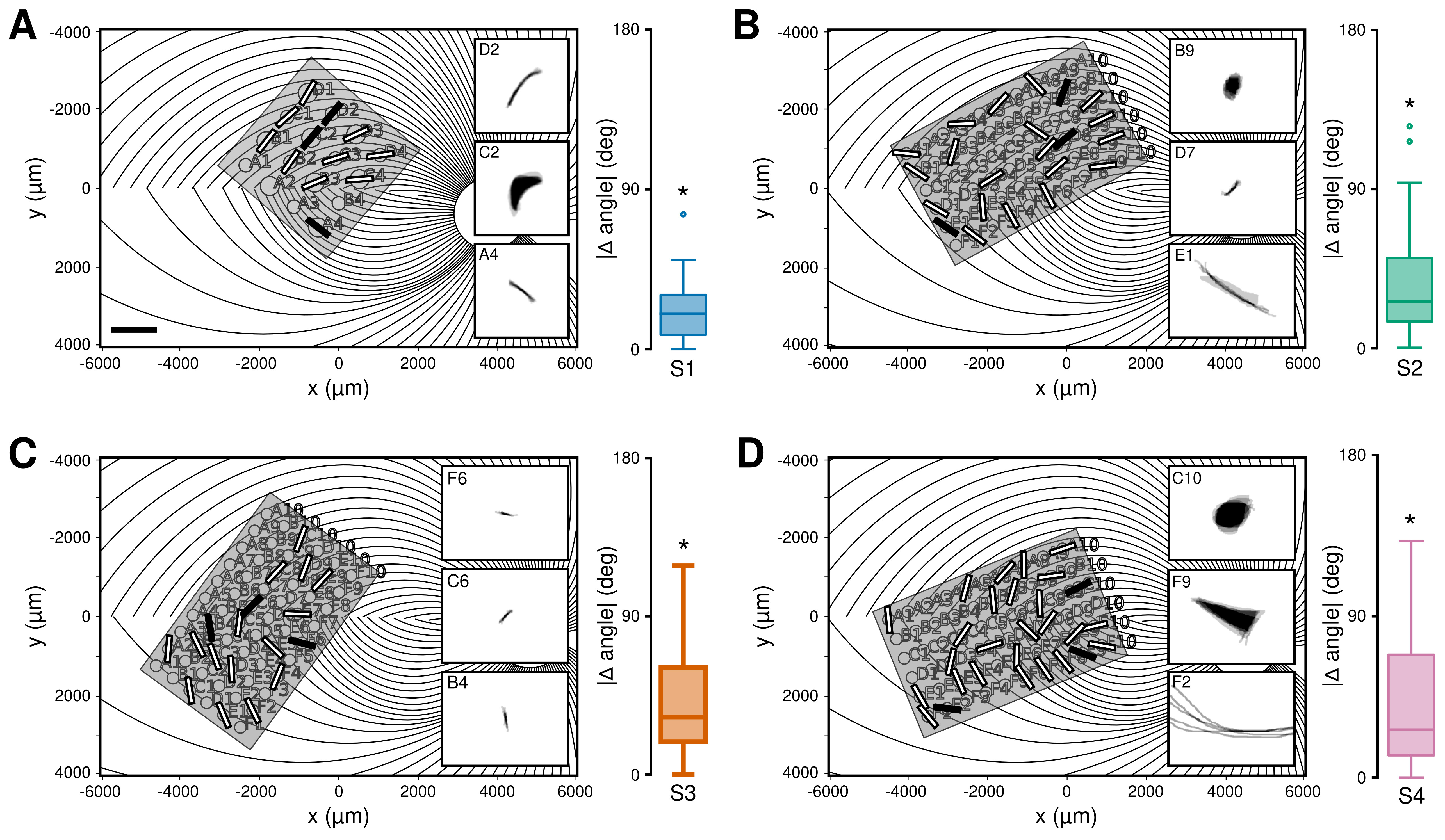 Panel D shows how the underlying geometry of retinal axons (gray lines) distorts the stimulation of individual electrocodes of Argus II. The resulting image is not perceived as a single “pixel” but as distorted shapes and lines. 